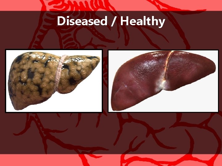 Diseased / Healthy 