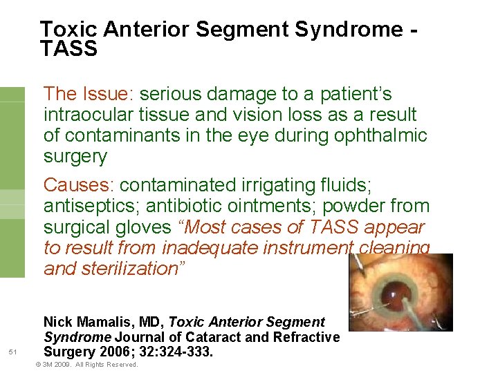 Toxic Anterior Segment Syndrome TASS The Issue: serious damage to a patient’s intraocular tissue
