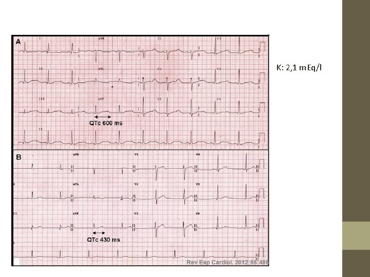 K: 2, 1 m. Eq/l 