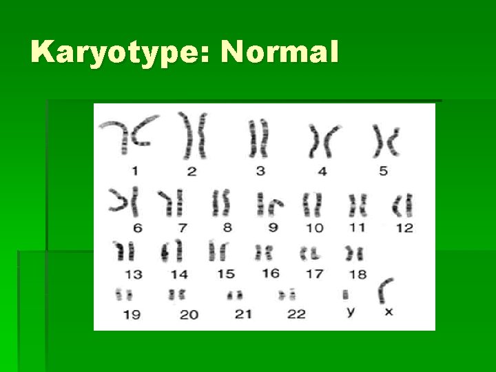 Karyotype: Normal 