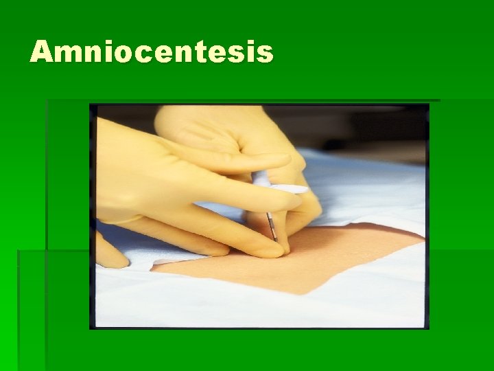 Amniocentesis 