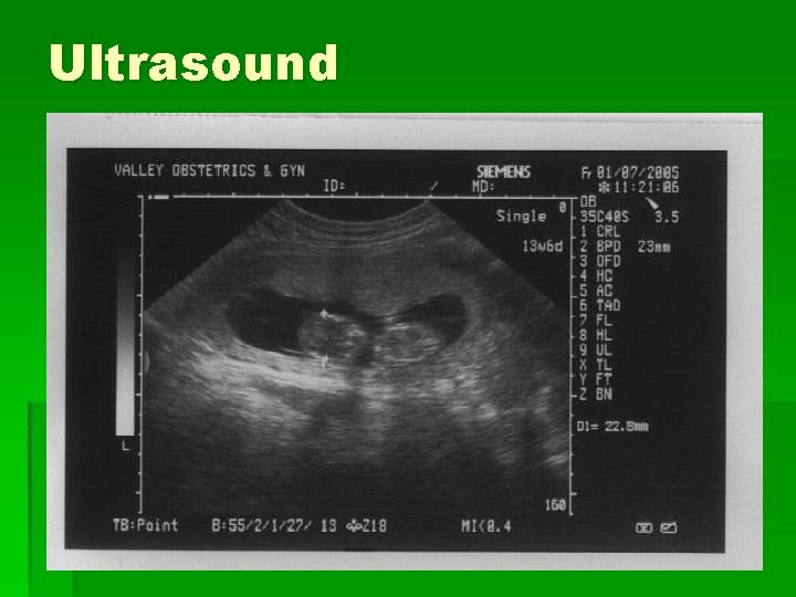 Ultrasound 