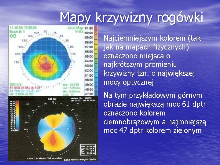 Mapy krzywizny rogówki Najciemniejszym kolorem (tak jak na mapach fizycznych) oznaczono miejsca o najkrótszym