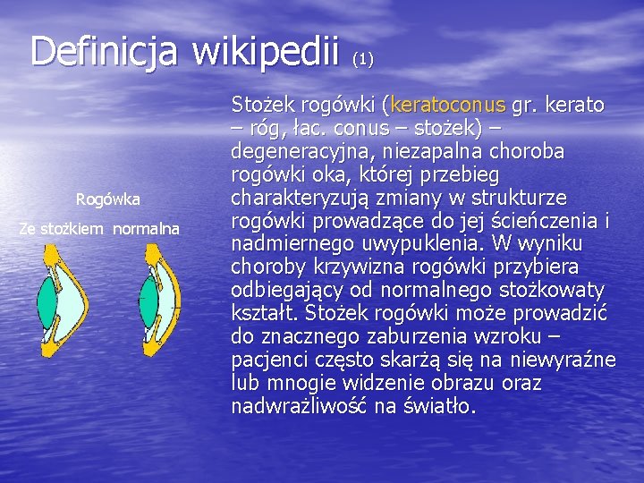 Definicja wikipedii (1) Rogówka Ze stożkiem normalna Stożek rogówki (keratoconus gr. kerato – róg,
