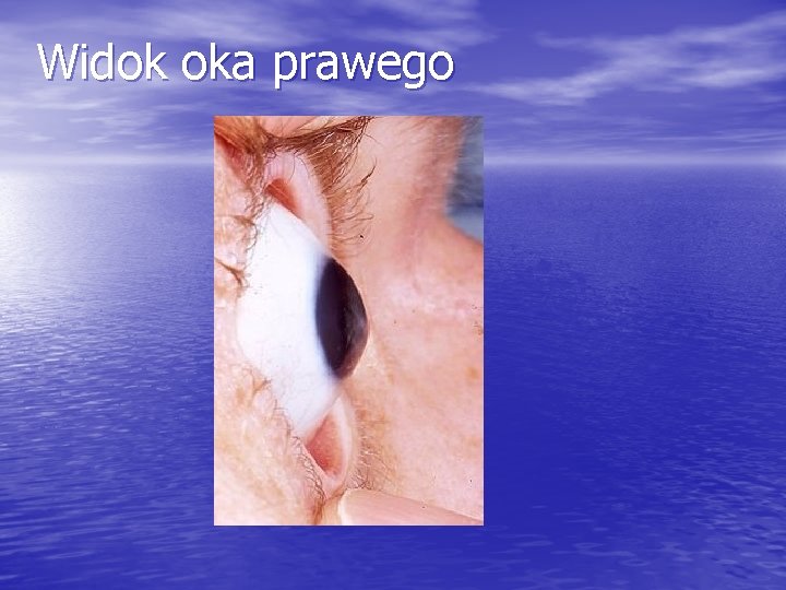 Widok oka prawego 