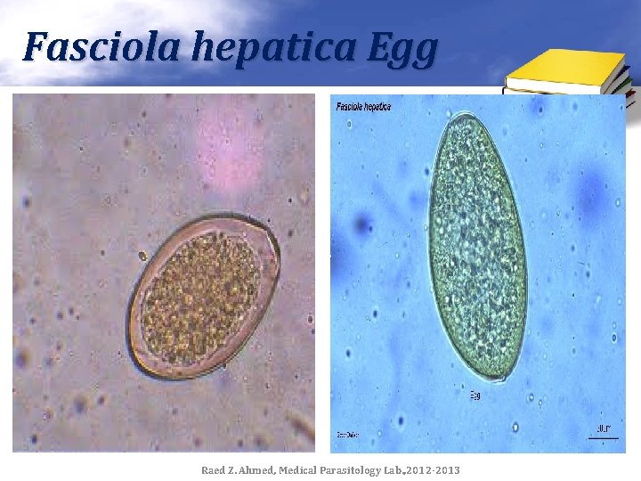 Fasciola hepatica Egg Raed Z. Ahmed, Medical Parasitology Lab. , 2012 -2013 