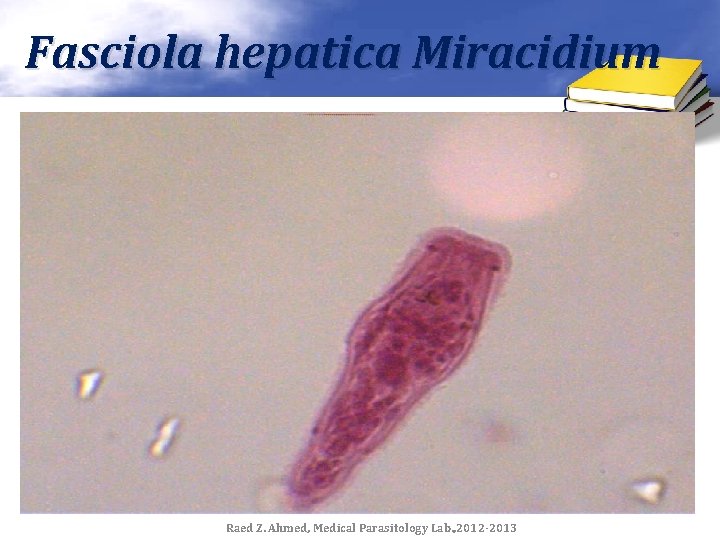 Fasciola hepatica Miracidium Raed Z. Ahmed, Medical Parasitology Lab. , 2012 -2013 