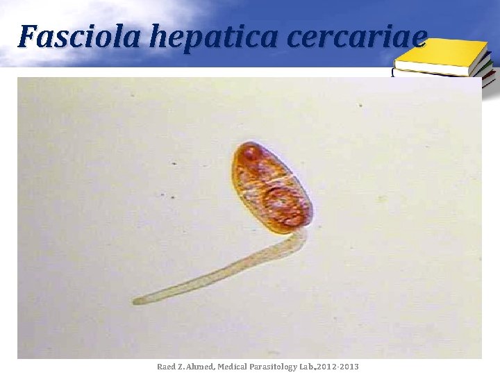 Fasciola hepatica cercariae Raed Z. Ahmed, Medical Parasitology Lab. , 2012 -2013 