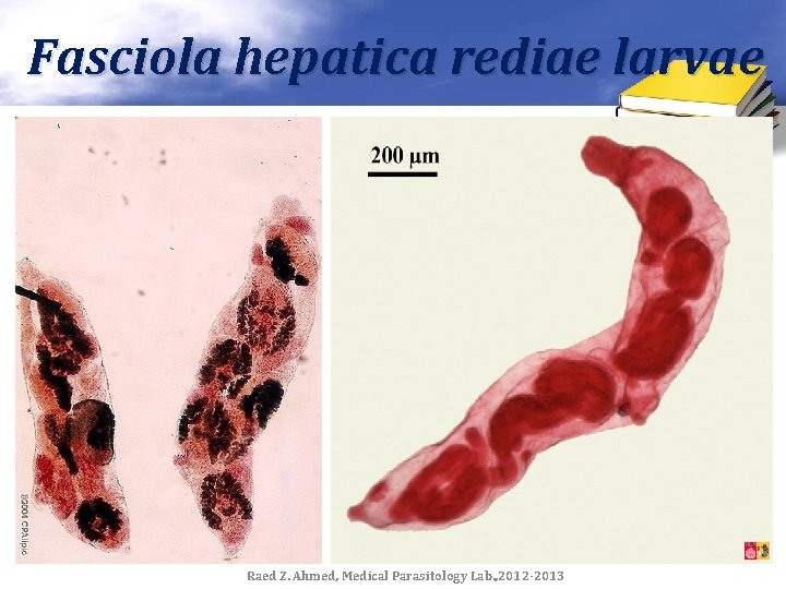 Fasciola hepatica rediae larvae Raed Z. Ahmed, Medical Parasitology Lab. , 2012 -2013 