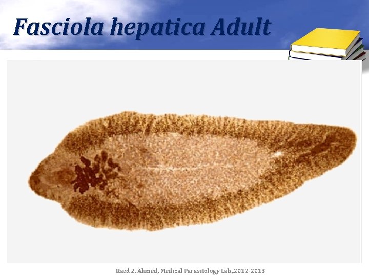 Fasciola hepatica Adult Raed Z. Ahmed, Medical Parasitology Lab. , 2012 -2013 
