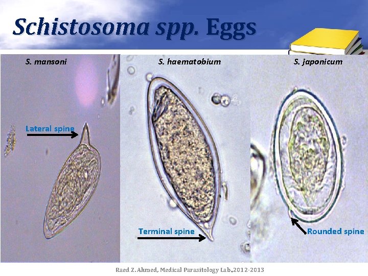 Schistosoma spp. Eggs S. mansoni S. haematobium S. japonicum Lateral spine Terminal spine Raed