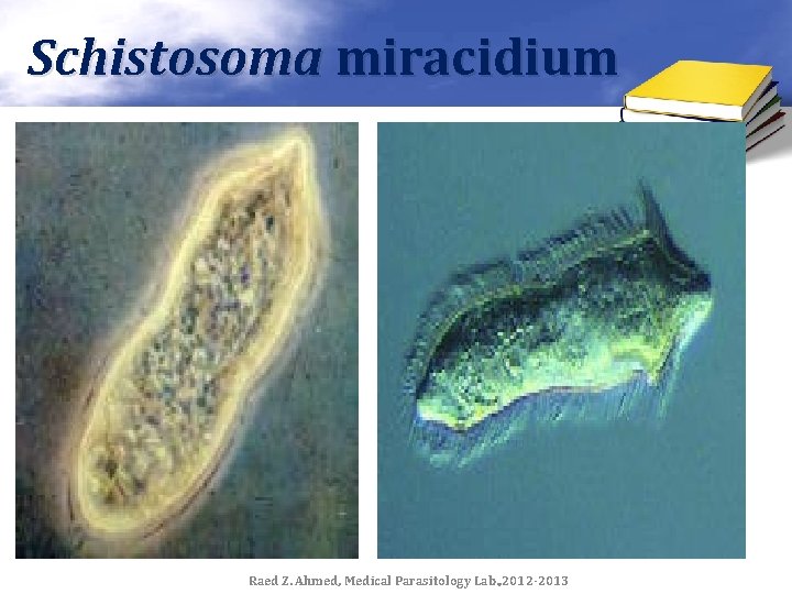 Schistosoma miracidium Raed Z. Ahmed, Medical Parasitology Lab. , 2012 -2013 