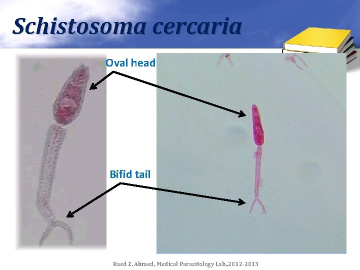 Schistosoma cercaria Oval head Bifid tail Raed Z. Ahmed, Medical Parasitology Lab. , 2012