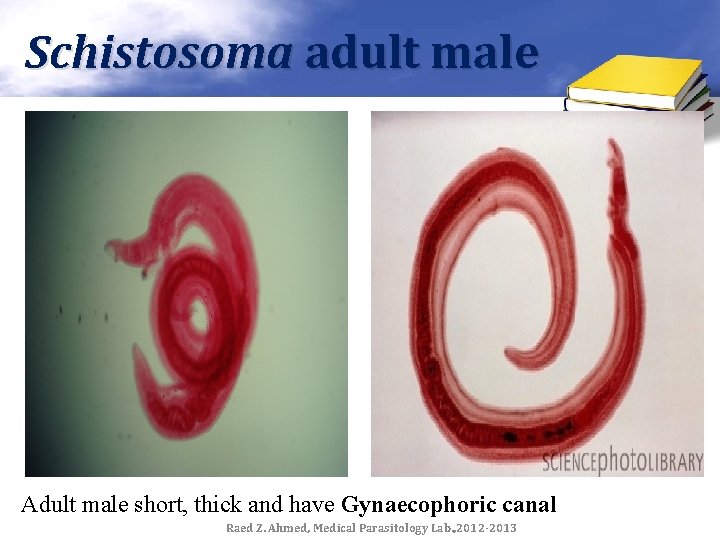 Schistosoma adult male Adult male short, thick and have Gynaecophoric canal Raed Z. Ahmed,