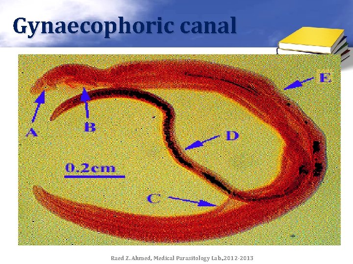 Gynaecophoric canal Raed Z. Ahmed, Medical Parasitology Lab. , 2012 -2013 