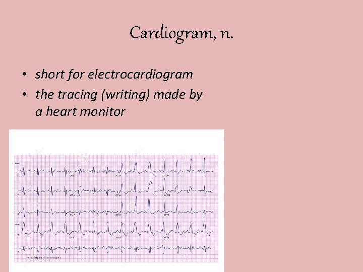 Cardiogram, n. • short for electrocardiogram • the tracing (writing) made by a heart