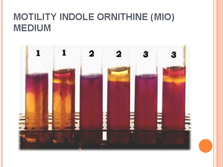 MOTILITY INDOLE ORNITHINE (MIO) MEDIUM 