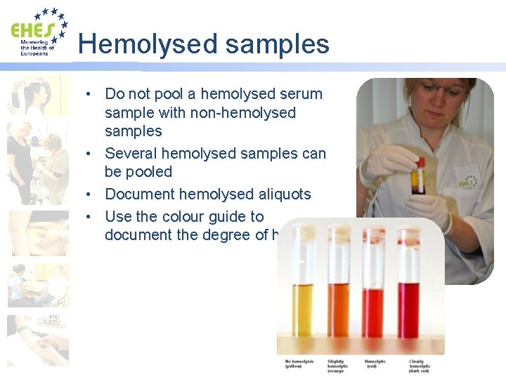 Hemolysed samples • Do not pool a hemolysed serum sample with non-hemolysed samples •