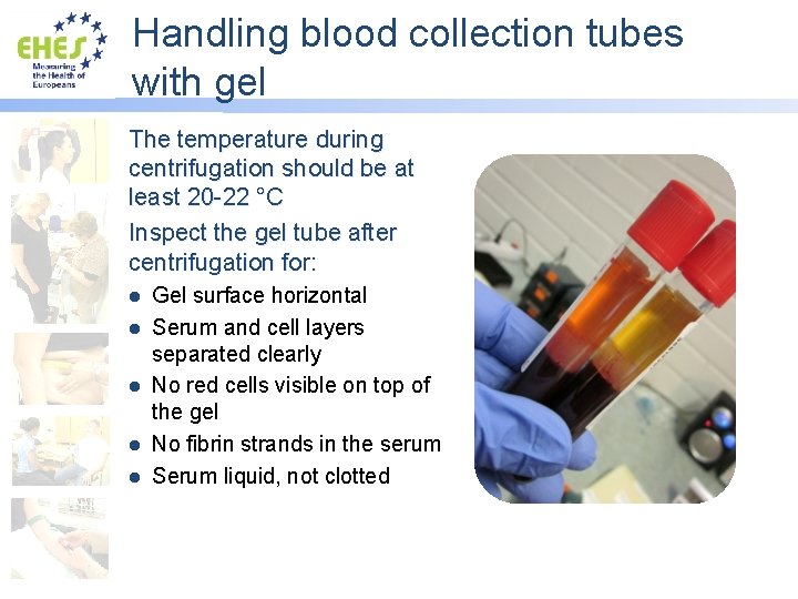 Handling blood collection tubes with gel The temperature during centrifugation should be at least