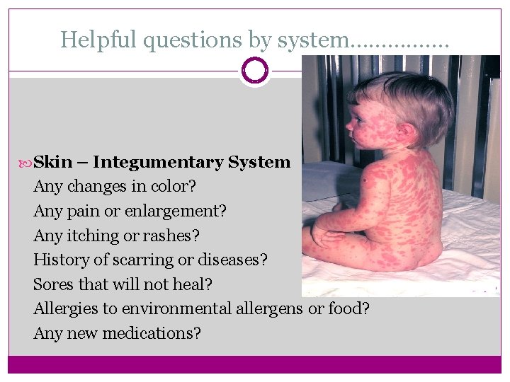 Helpful questions by system……………. Skin – Integumentary System Any changes in color? Any pain