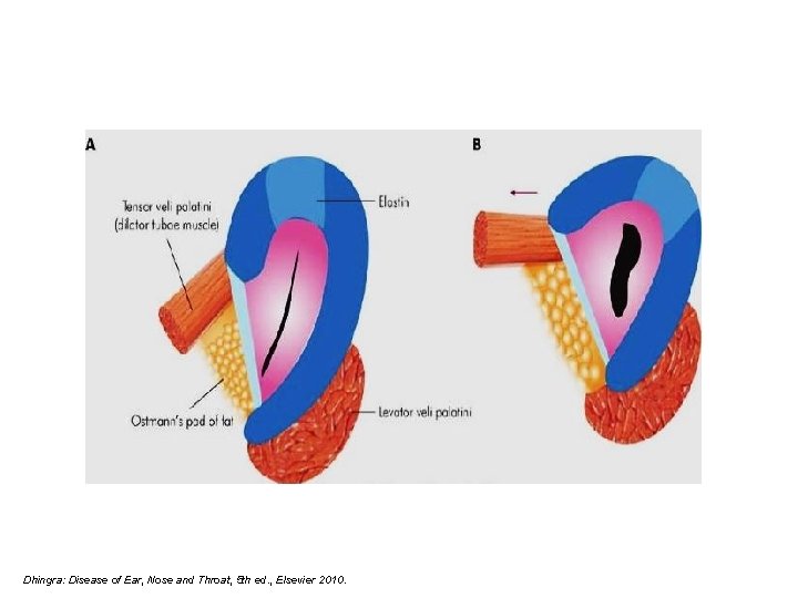 Dhingra: Disease of Ear, Nose and Throat, 5 th ed. , Elsevier 2010. 