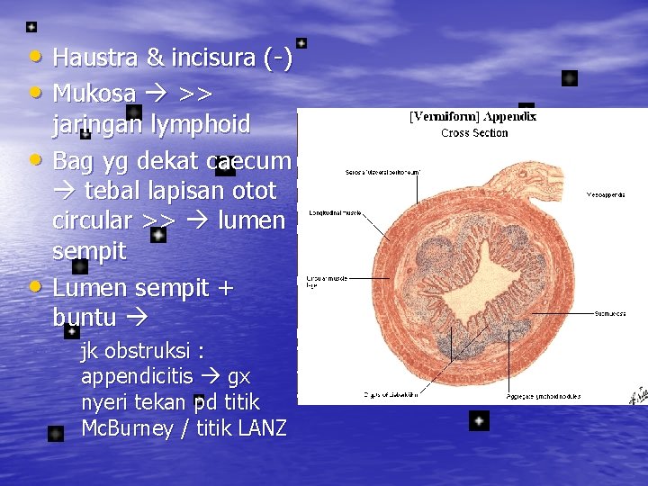  • Haustra & incisura (-) • Mukosa >> • • jaringan lymphoid Bag