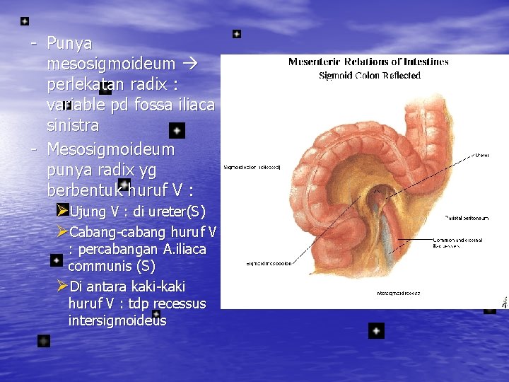 - Punya mesosigmoideum perlekatan radix : variable pd fossa iliaca sinistra - Mesosigmoideum punya