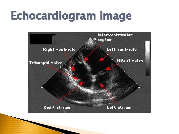 Echocardiogram image 