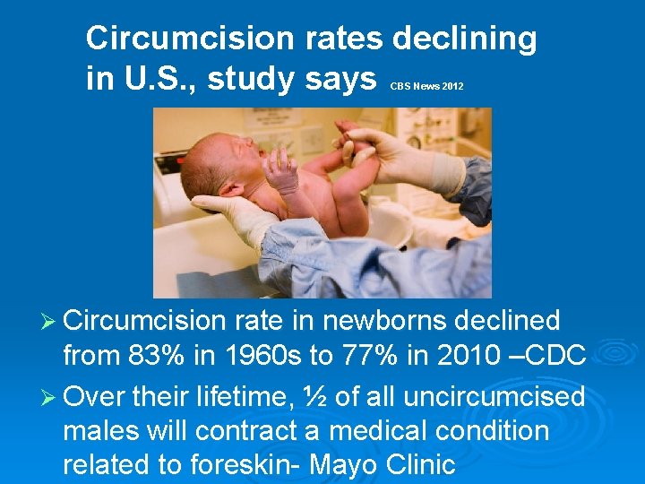 Circumcision rates declining in U. S. , study says CBS News 2012 Ø Circumcision