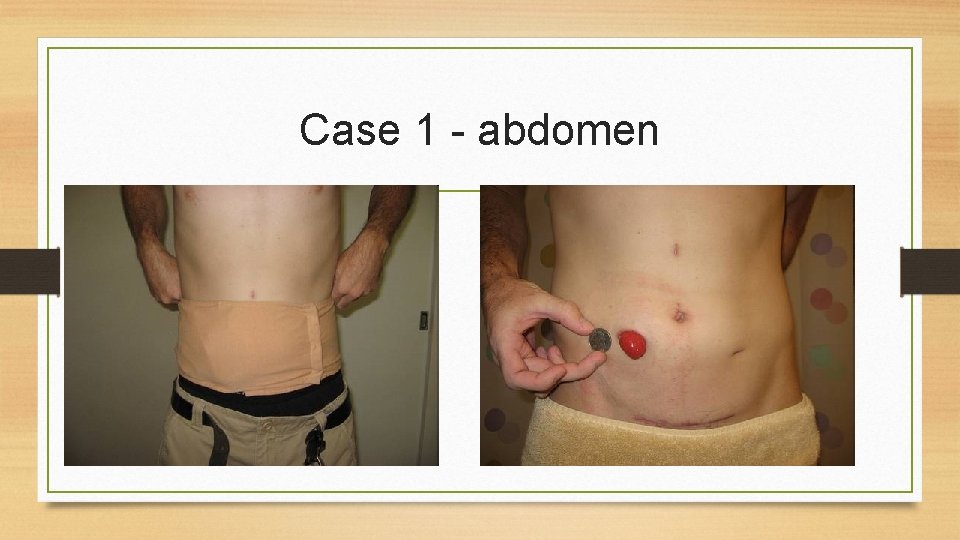 Case 1 - abdomen 