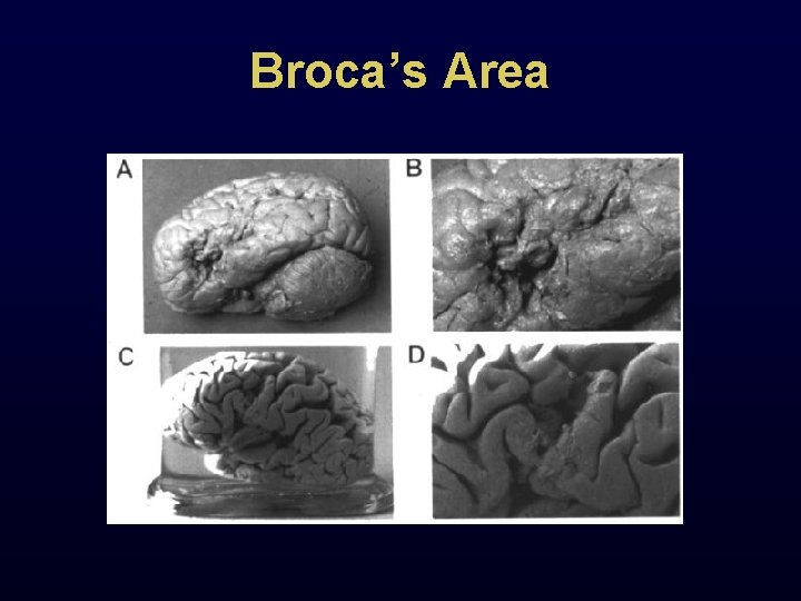 Broca’s Area 