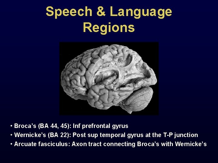 Speech & Language Regions • Broca’s (BA 44, 45): Inf prefrontal gyrus • Wernicke’s