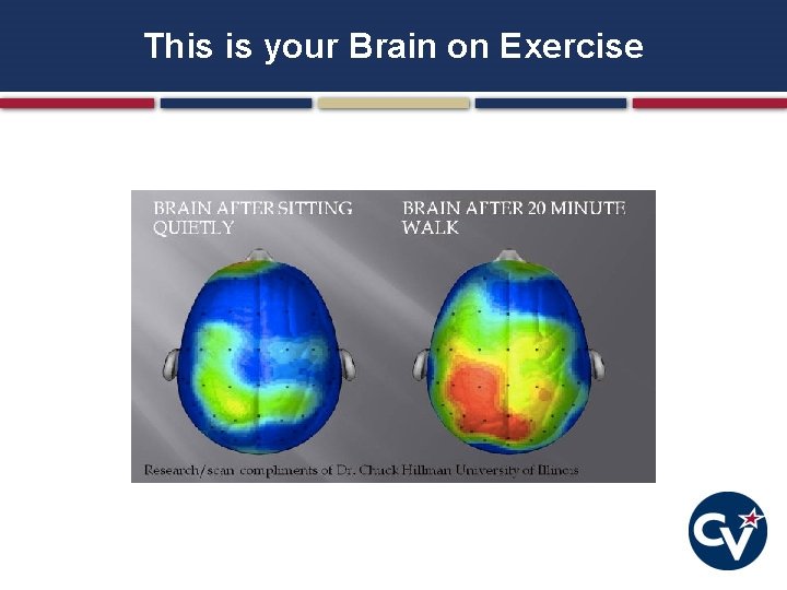 This is your Brain on Exercise 