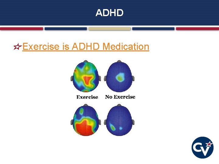 ADHD Exercise is ADHD Medication 