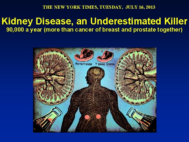 THE NEW YORK TIMES, TUESDAY, JULY 16, 2013 Kidney Disease, an Underestimated Killer 90,