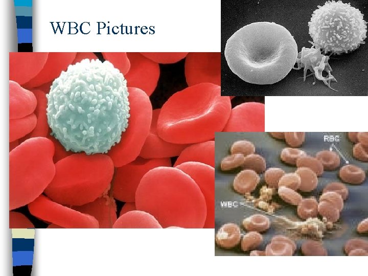 WBC Pictures 
