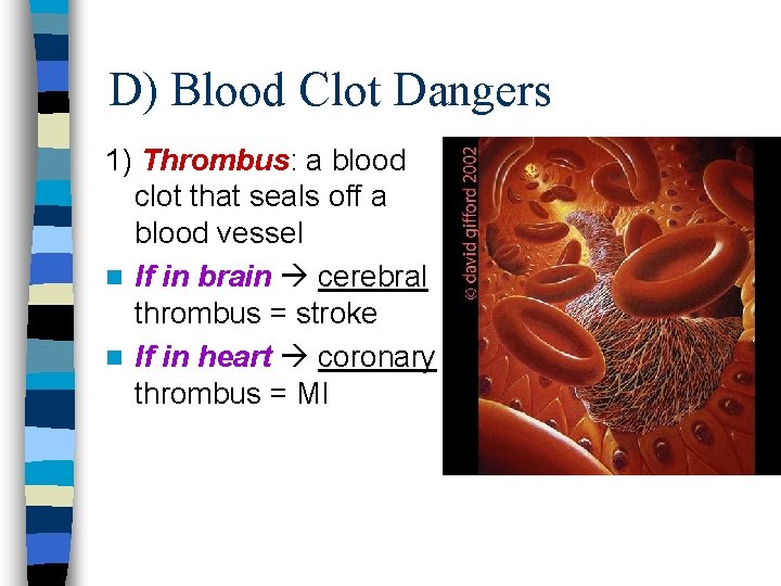 D) Blood Clot Dangers 1) Thrombus: a blood clot that seals off a blood