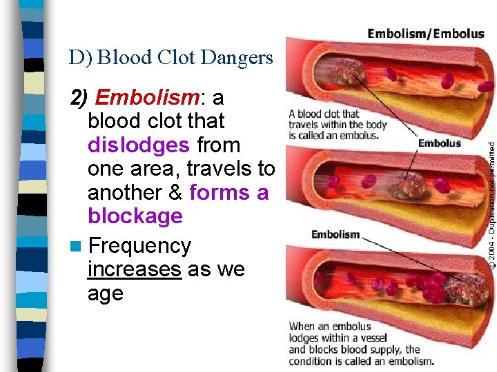 D) Blood Clot Dangers 2) Embolism: a blood clot that dislodges from one area,