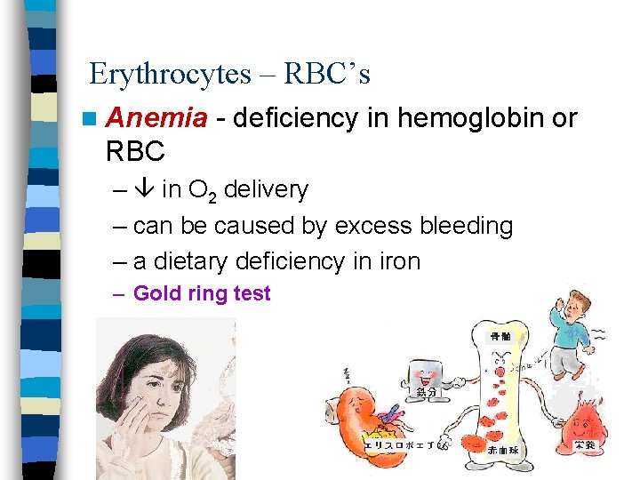 Erythrocytes – RBC’s n Anemia - deficiency in hemoglobin or RBC – in O