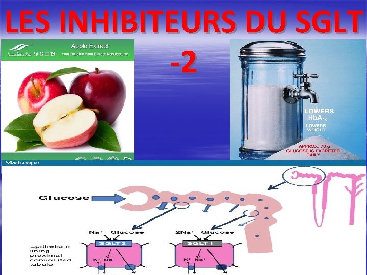 LES INHIBITEURS DU SGLT -2 