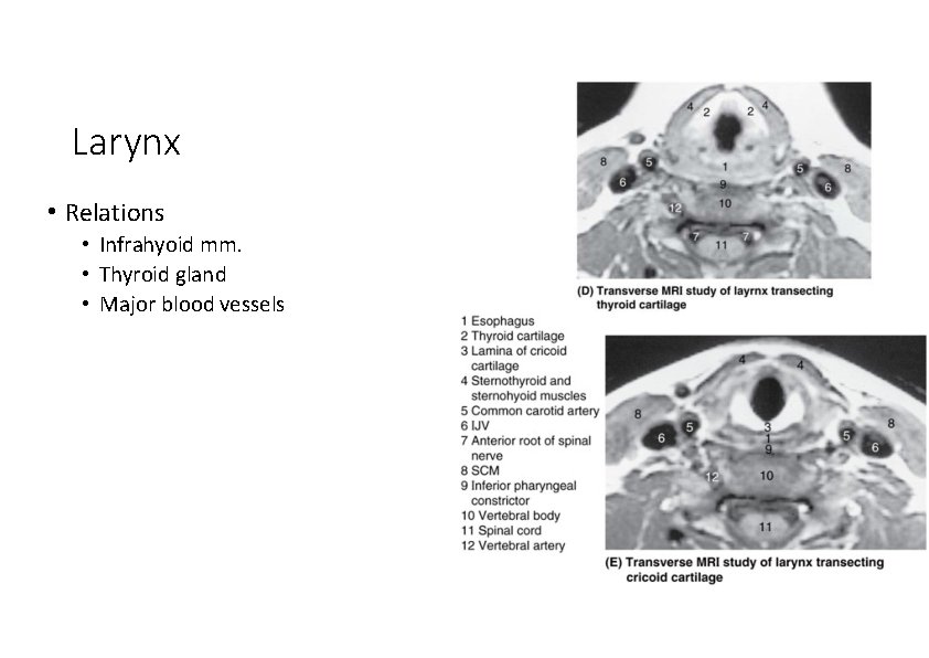 Larynx • Relations • Infrahyoid mm. • Thyroid gland • Major blood vessels 