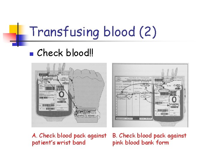 Transfusing blood (2) n Check blood!! A. Check blood pack against B. Check blood