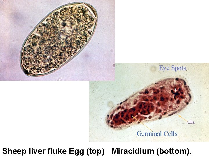 Sheep liver fluke Egg (top) Miracidium (bottom). 
