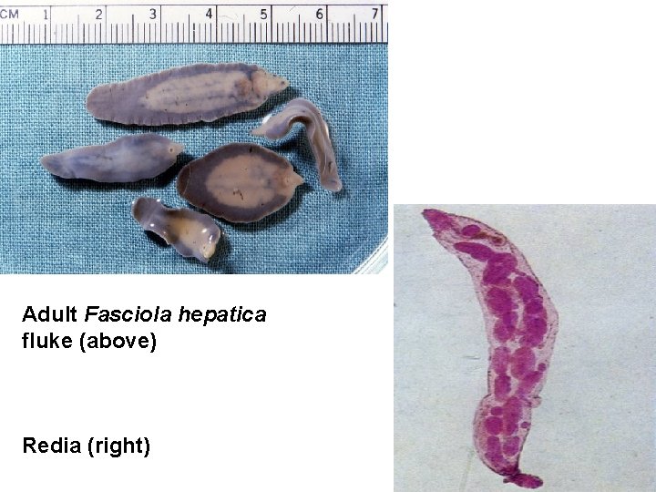 Adult Fasciola hepatica fluke (above) Redia (right) 