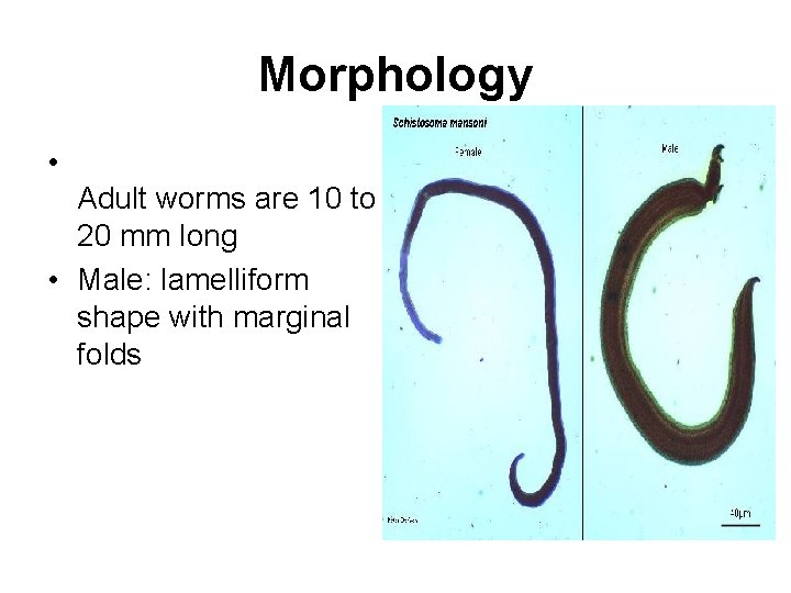 Morphology • Adult worms are 10 to 20 mm long • Male: lamelliform shape