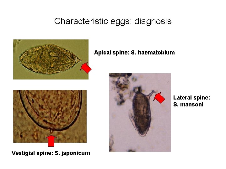 Characteristic eggs: diagnosis Apical spine: S. haematobium Lateral spine: S. mansoni Vestigial spine: S.