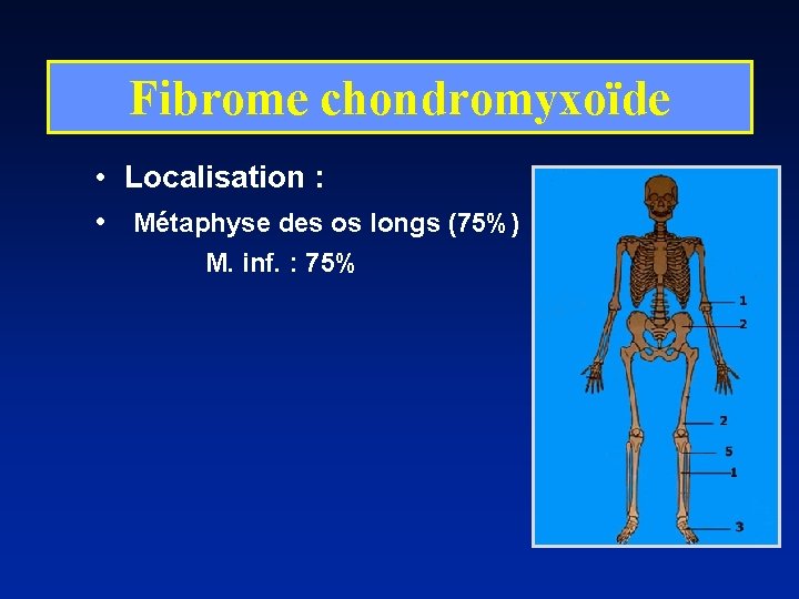 Fibrome chondromyxoïde • Localisation : • Métaphyse des os longs (75%) M. inf. :