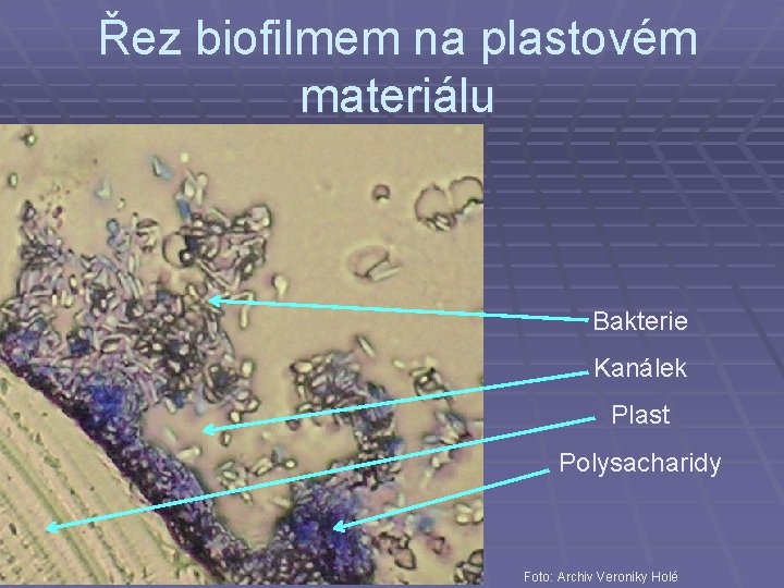 Řez biofilmem na plastovém materiálu Bakterie Kanálek Plast Polysacharidy Foto: Archiv Veroniky Holé 