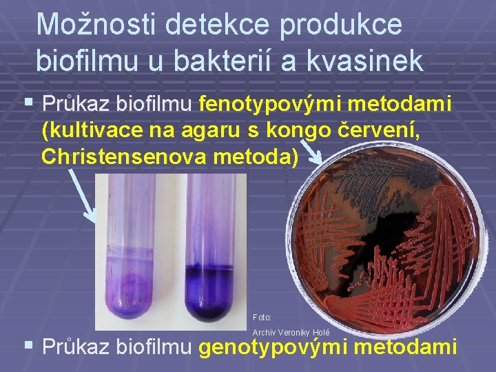 Možnosti detekce produkce biofilmu u bakterií a kvasinek § Průkaz biofilmu fenotypovými metodami (kultivace