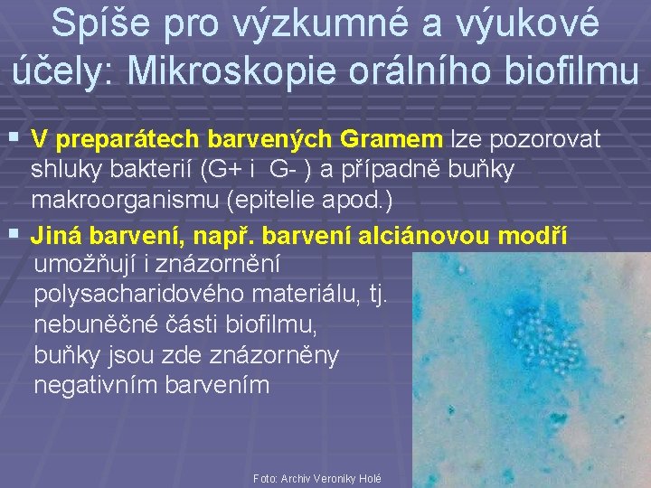 Spíše pro výzkumné a výukové účely: Mikroskopie orálního biofilmu § V preparátech barvených Gramem